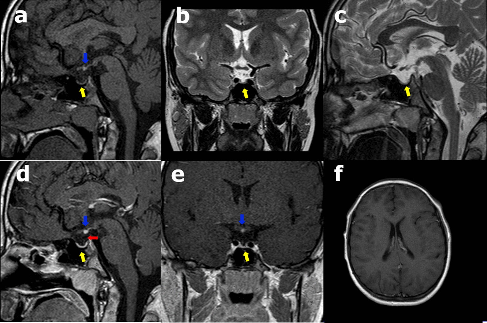 Fig. 2