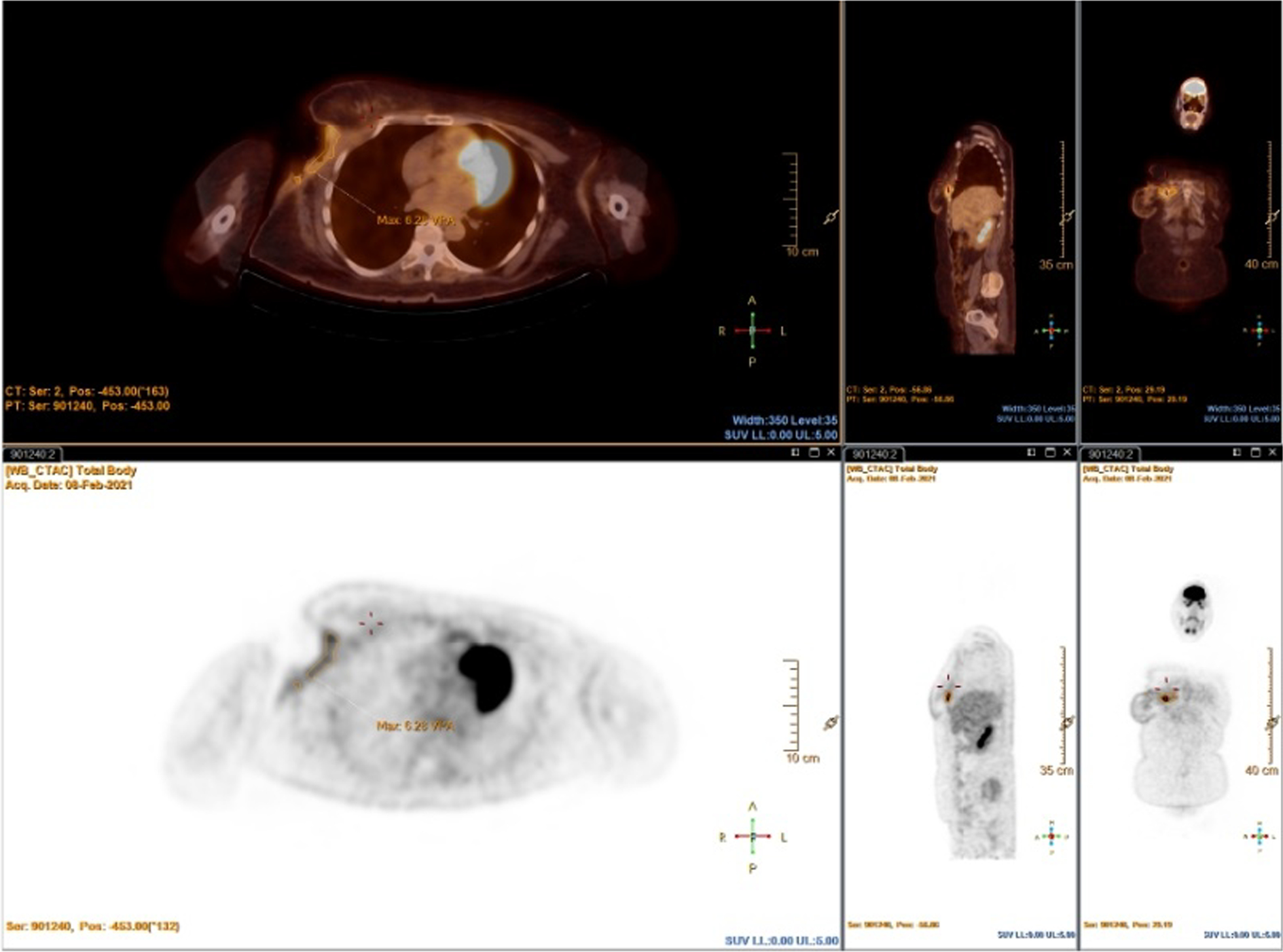 Fig. 4