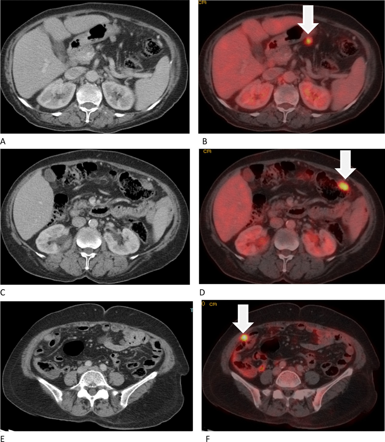 Fig. 4