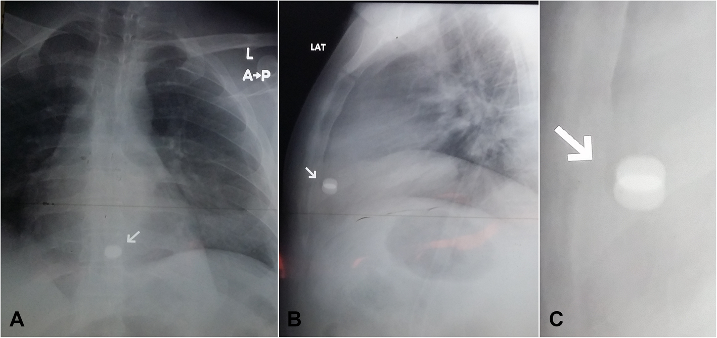 Fig. 2