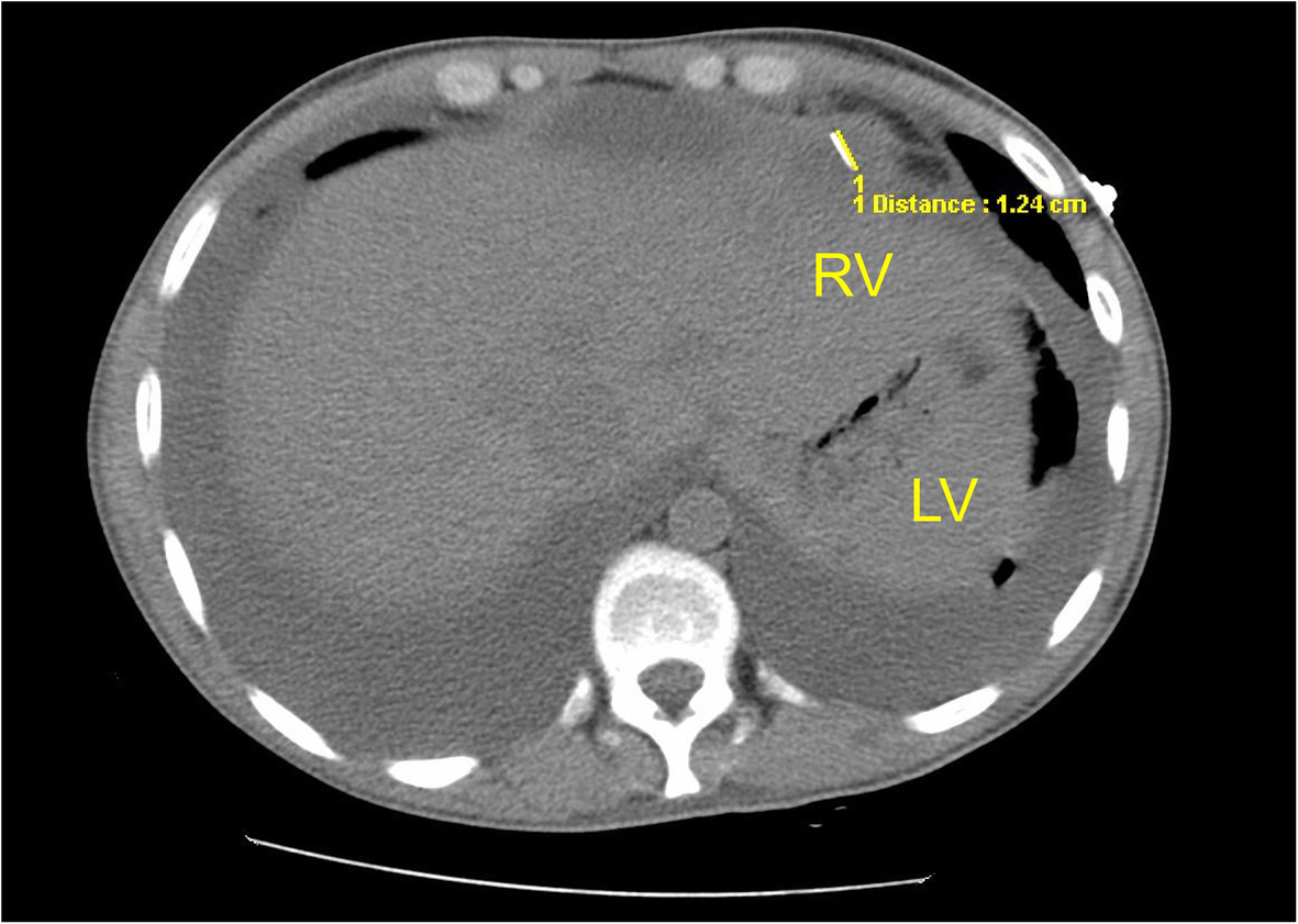 Fig. 1