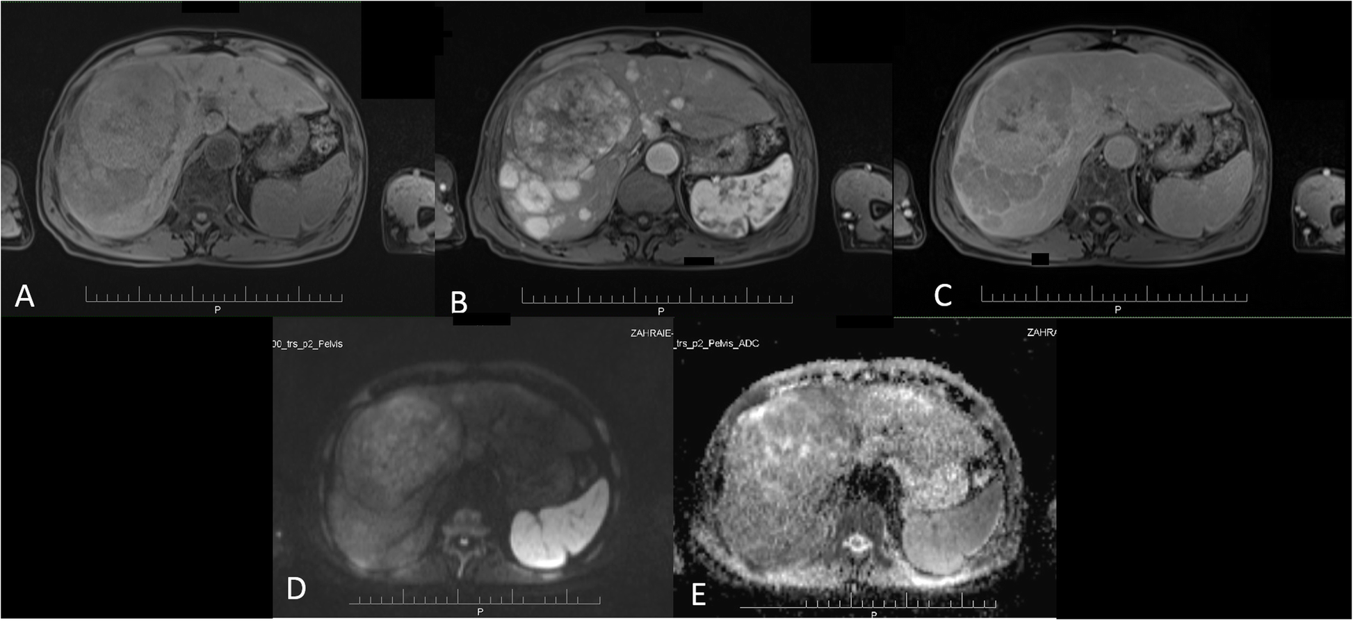 Fig. 6