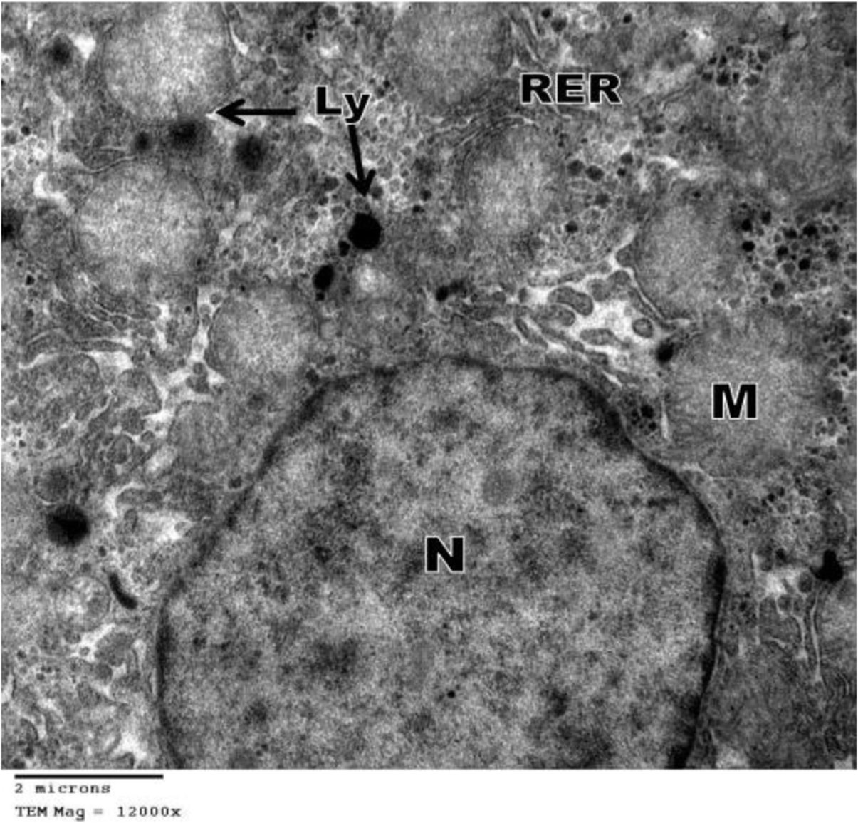 Fig. 14