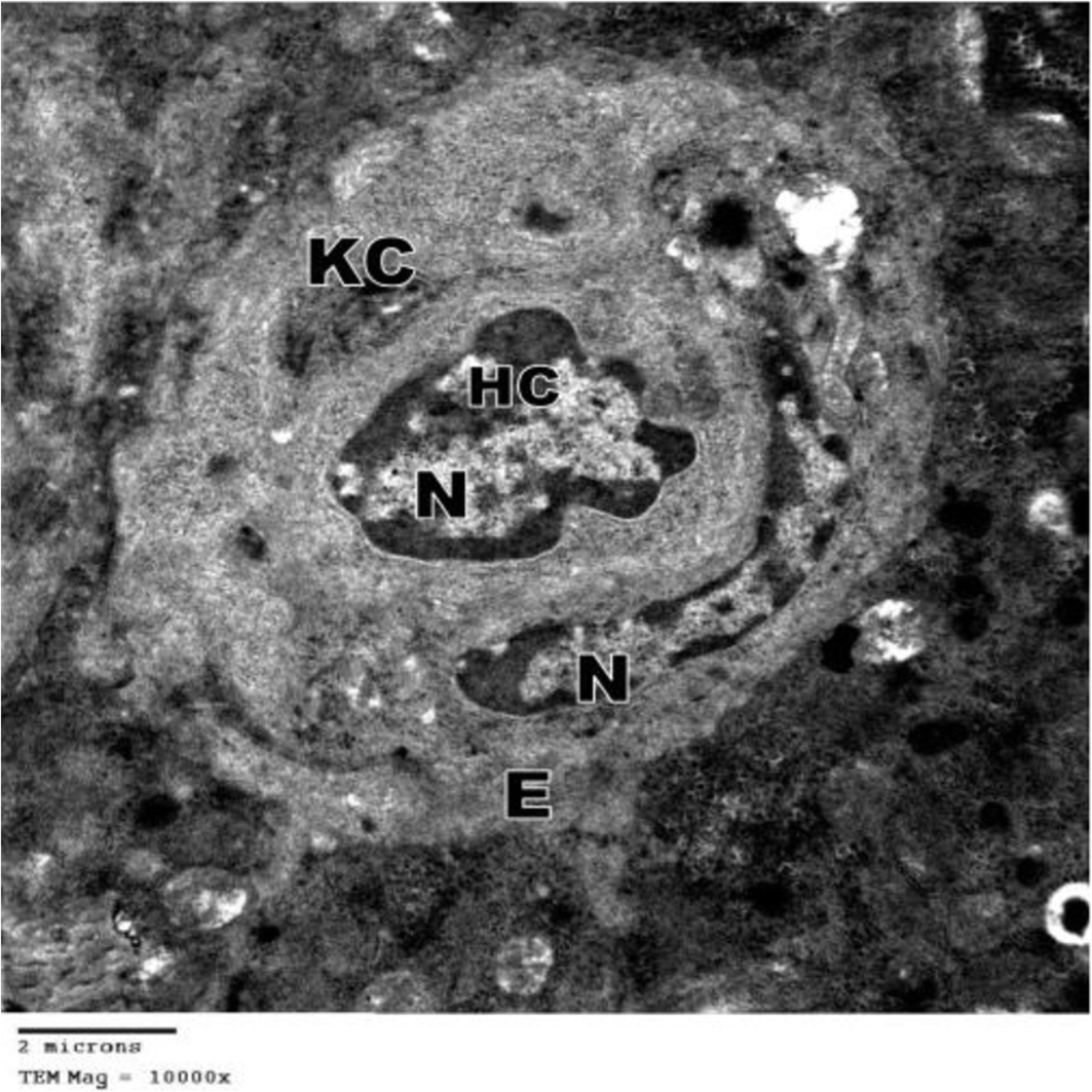 Fig. 22