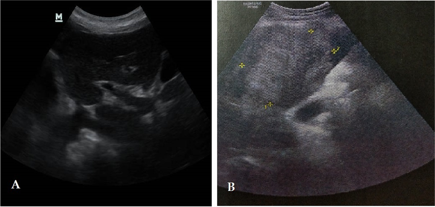 Fig. 2 