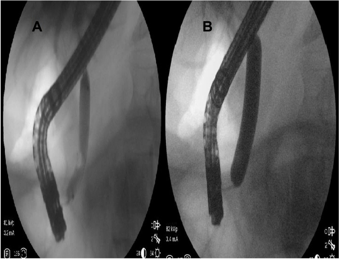 Fig. 2