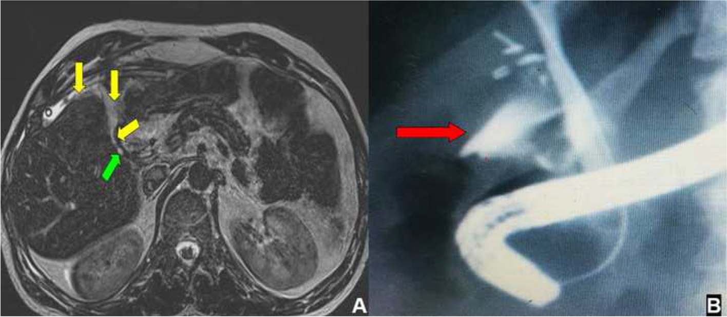 Fig. 11