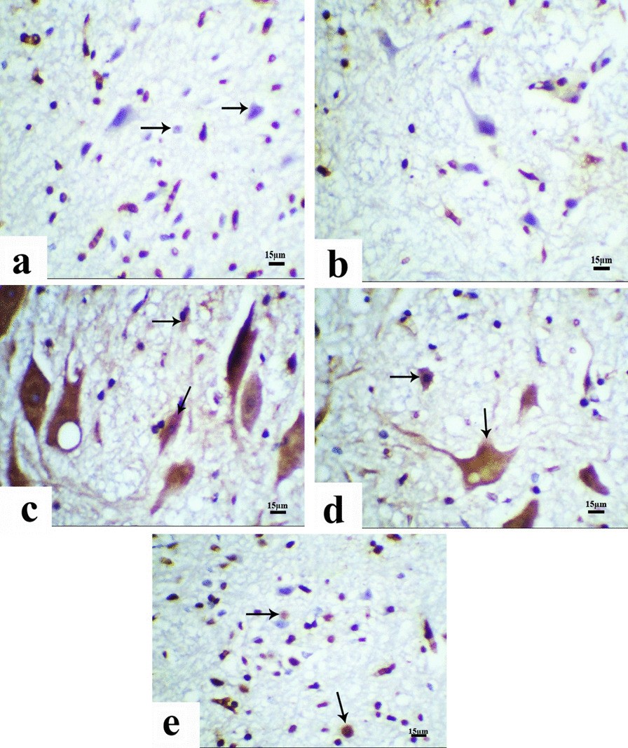 Fig. 12