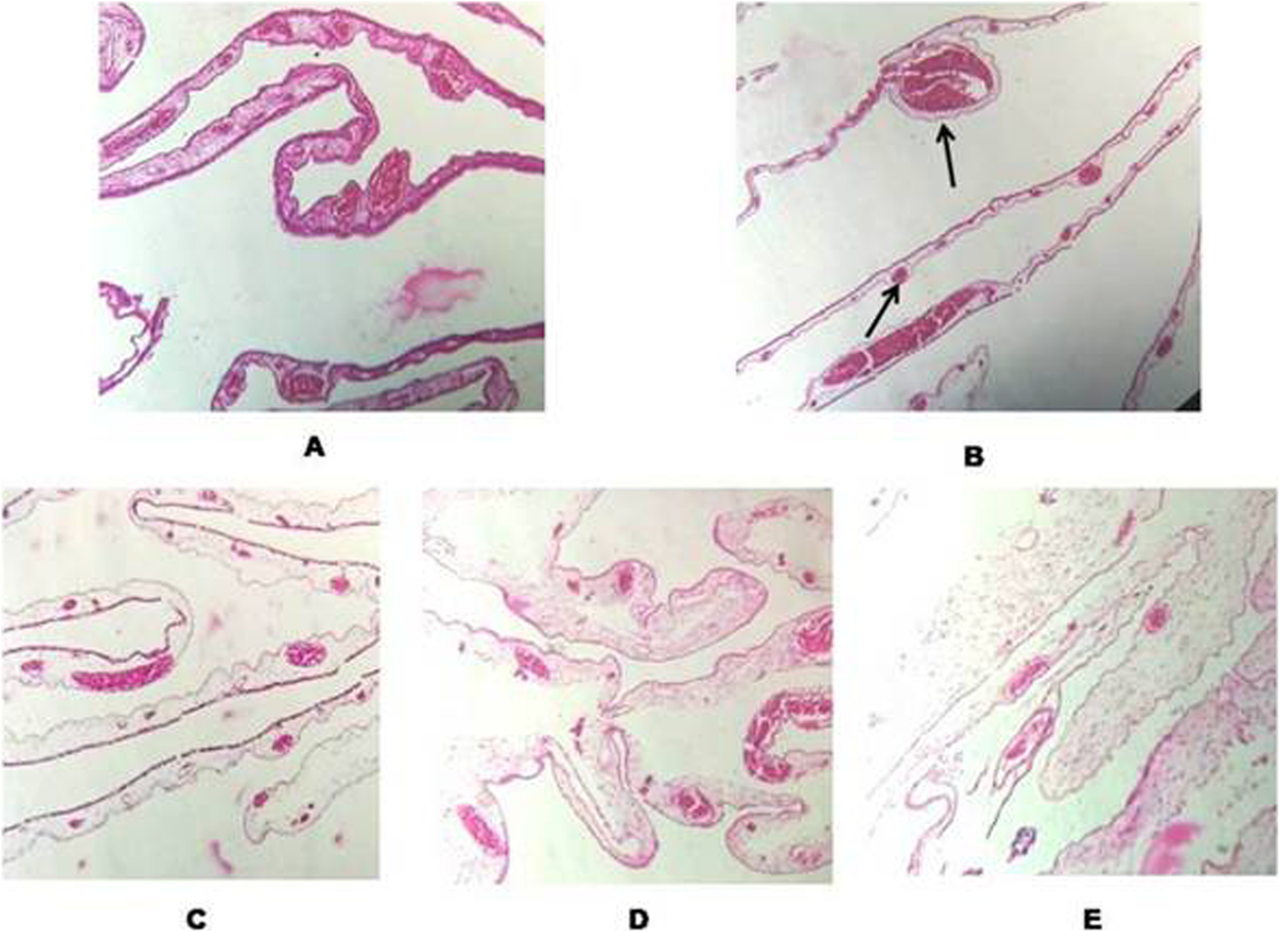 Fig. 11