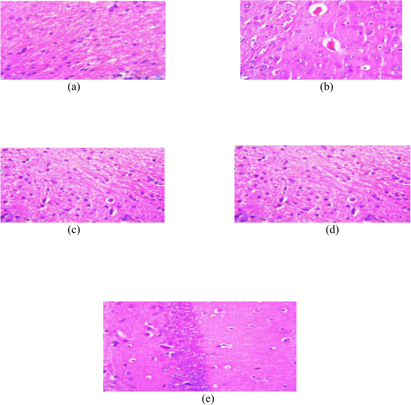 Fig. 12