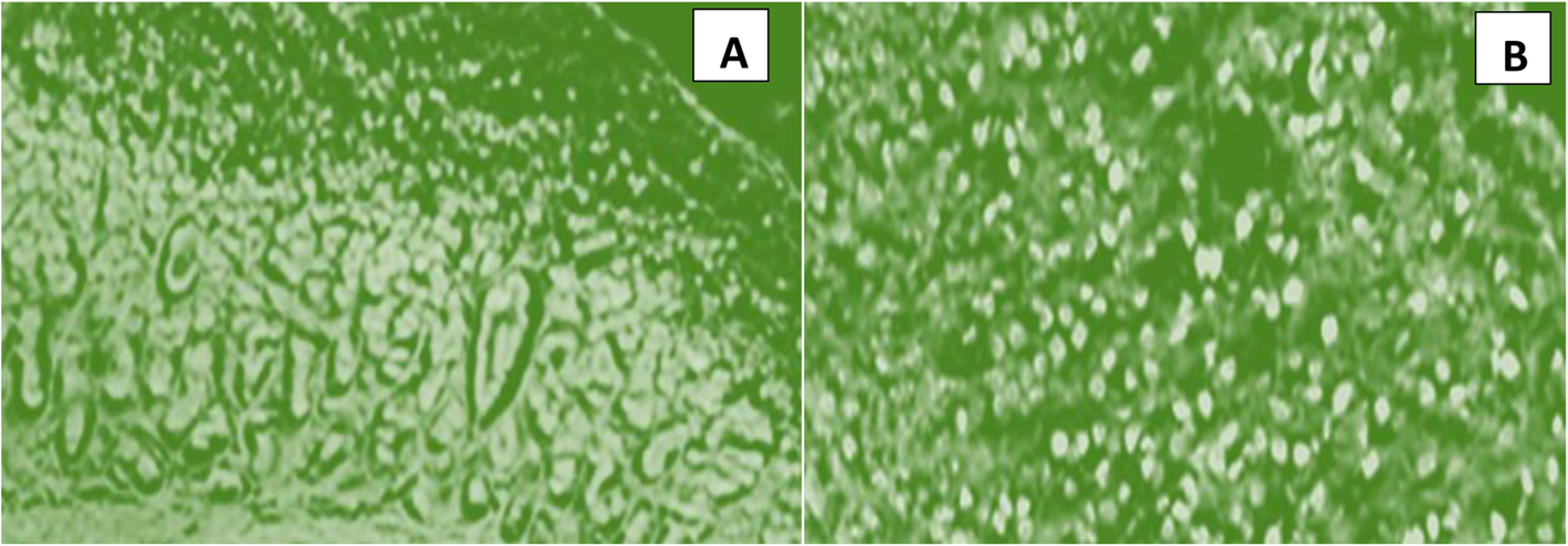 Fig. 10