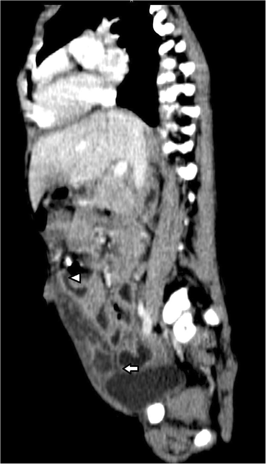 Fig. 1