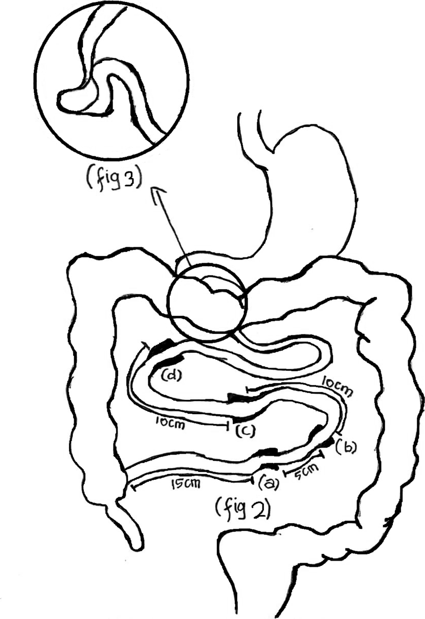 Fig. 4