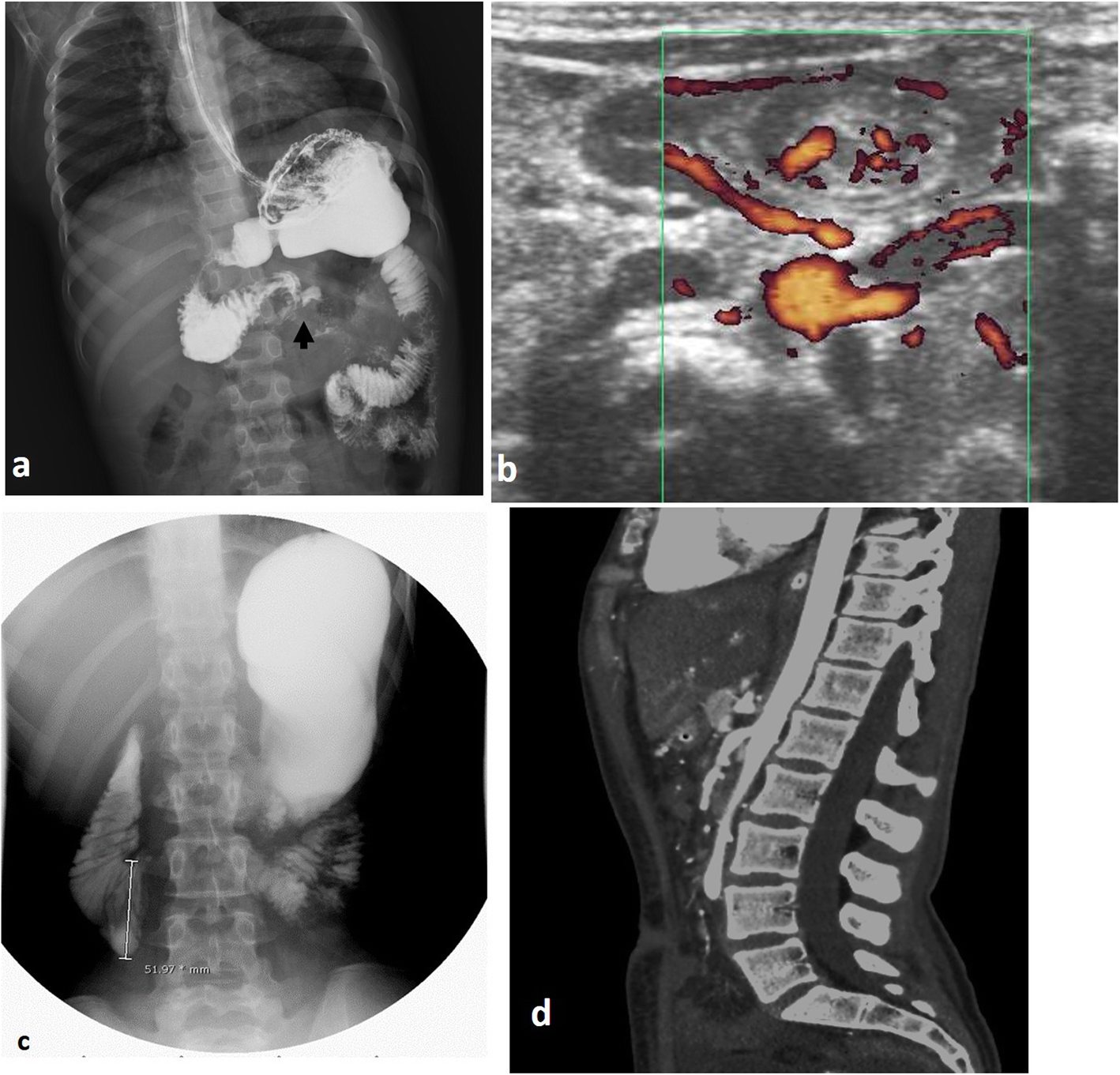 Fig. 4