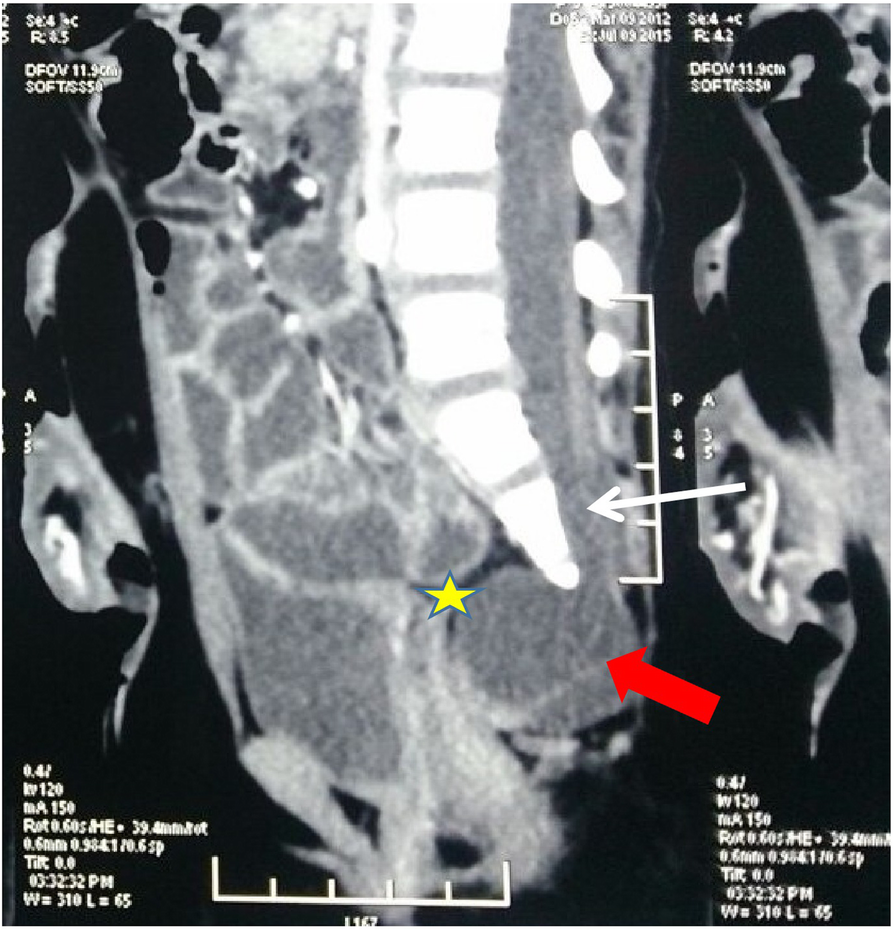 Fig. 1