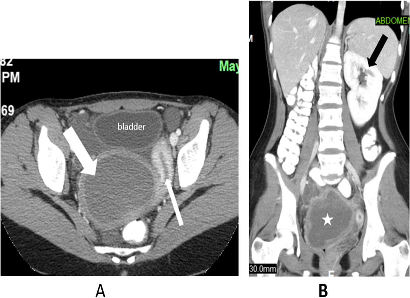 Fig. 2