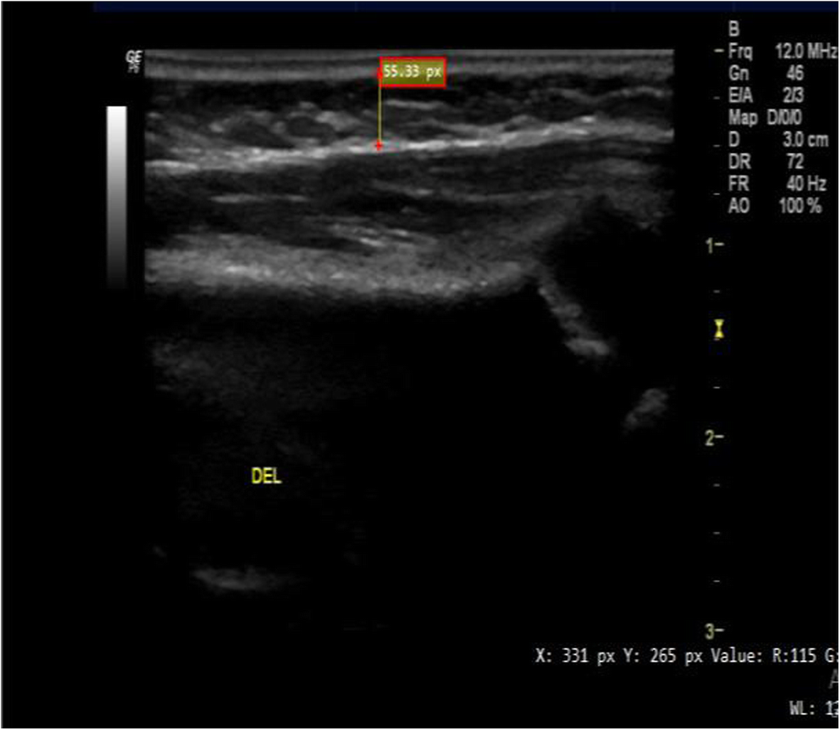 Fig. 2