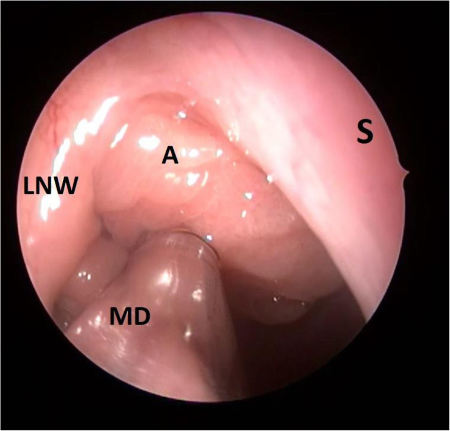 Fig. 3