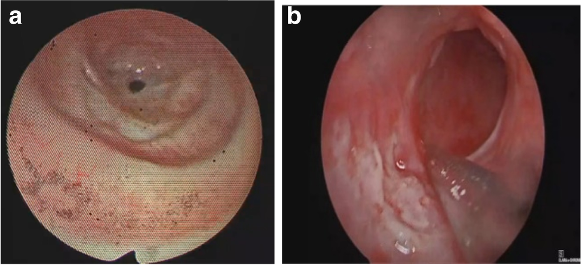 Fig. 8