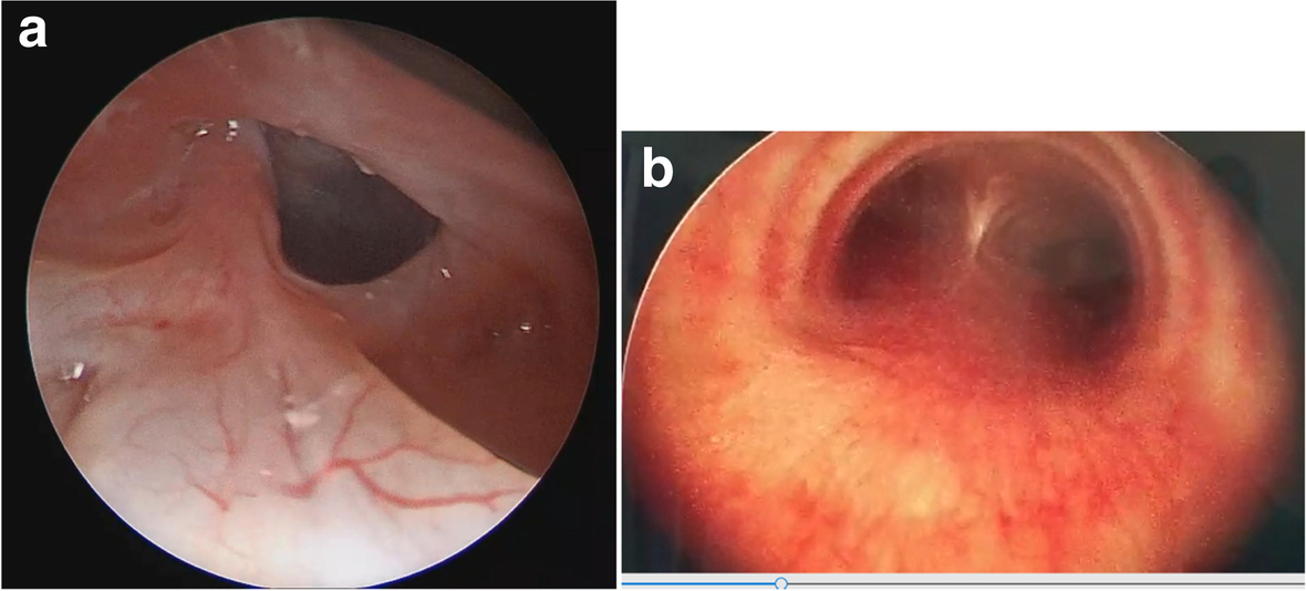 Fig. 9