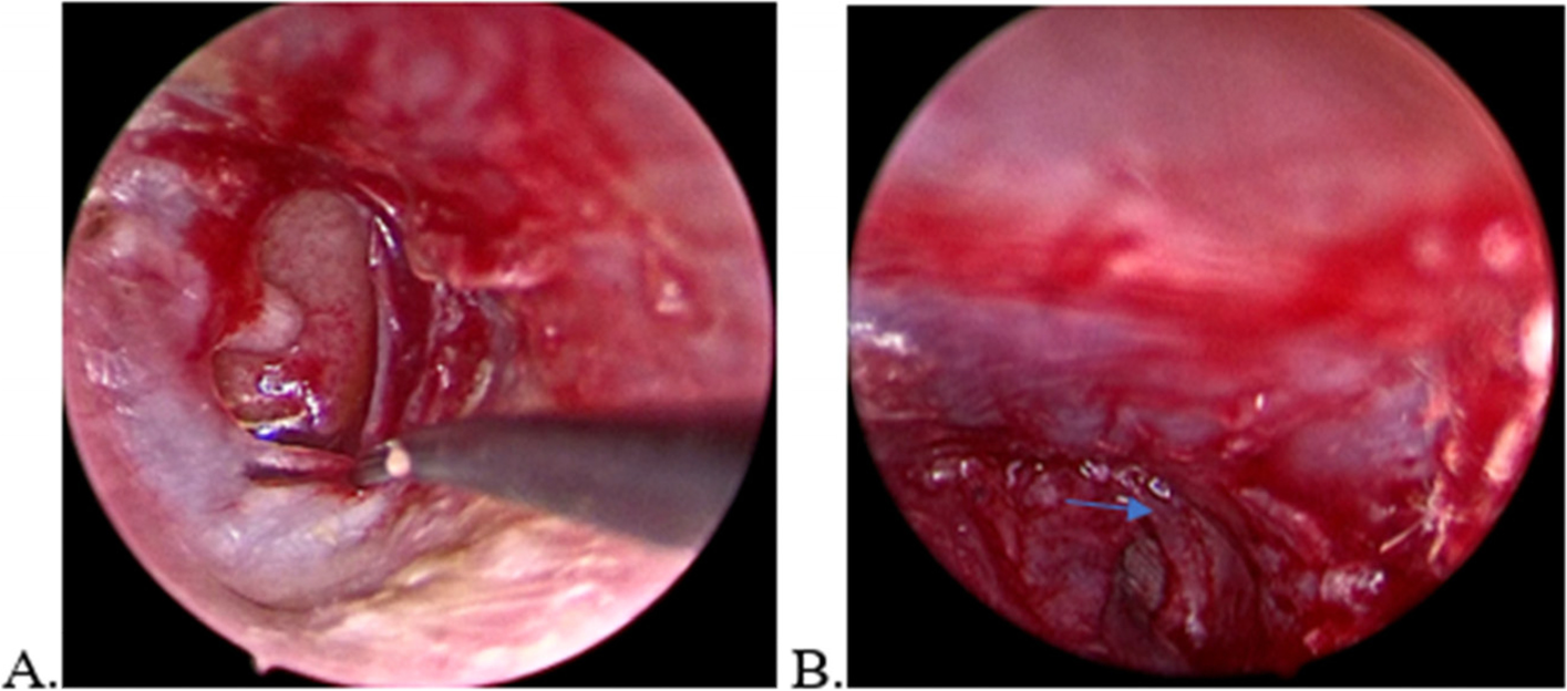 Fig. 4