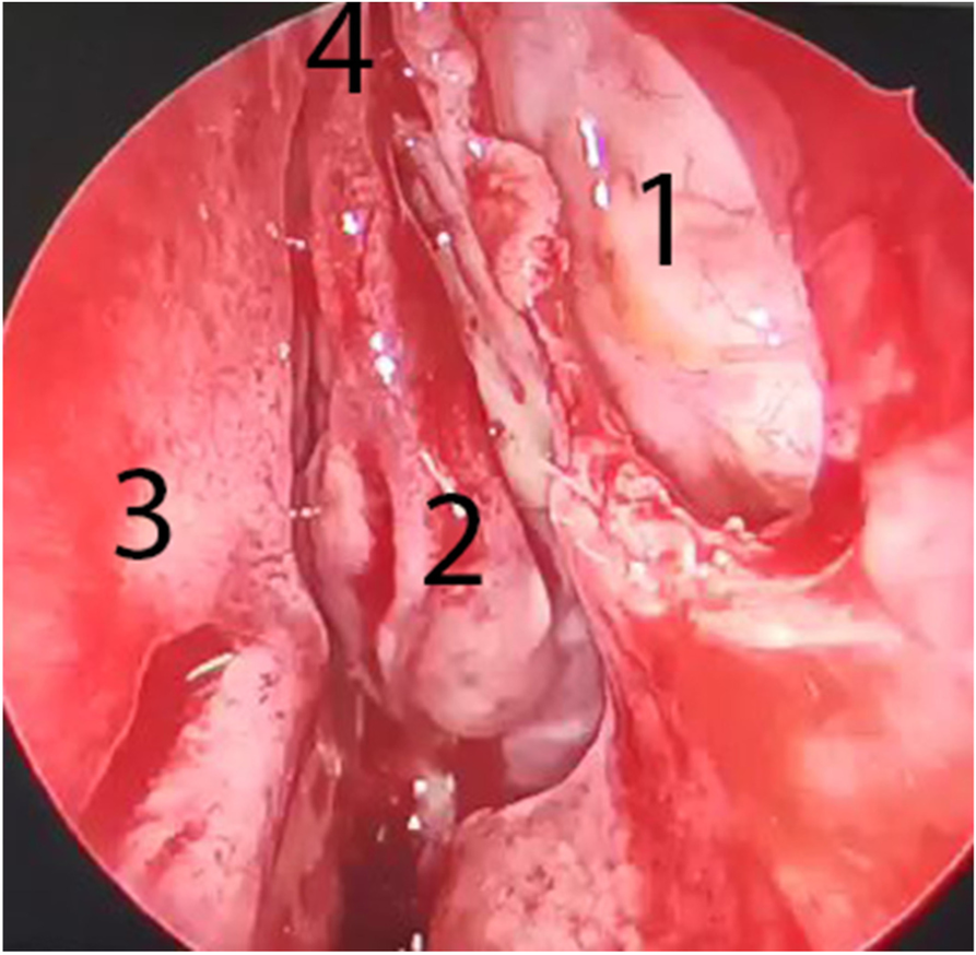 Fig. 3