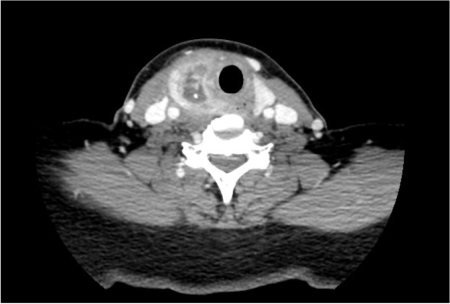 Fig. 1