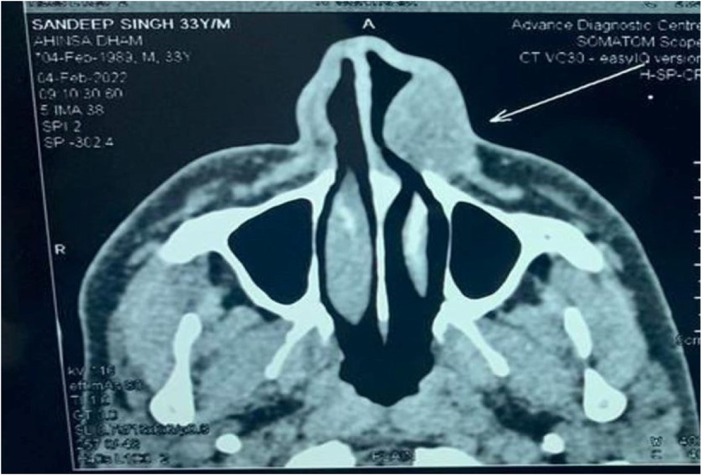 Fig. 2