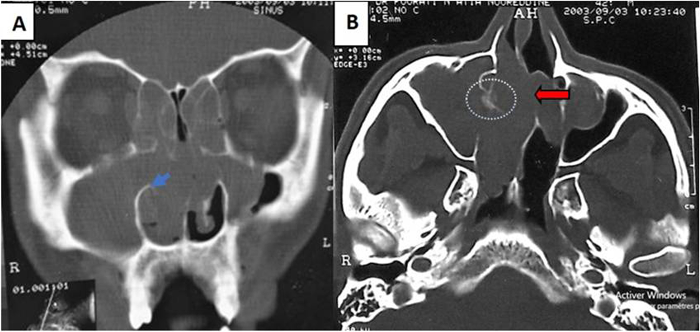 Fig. 3