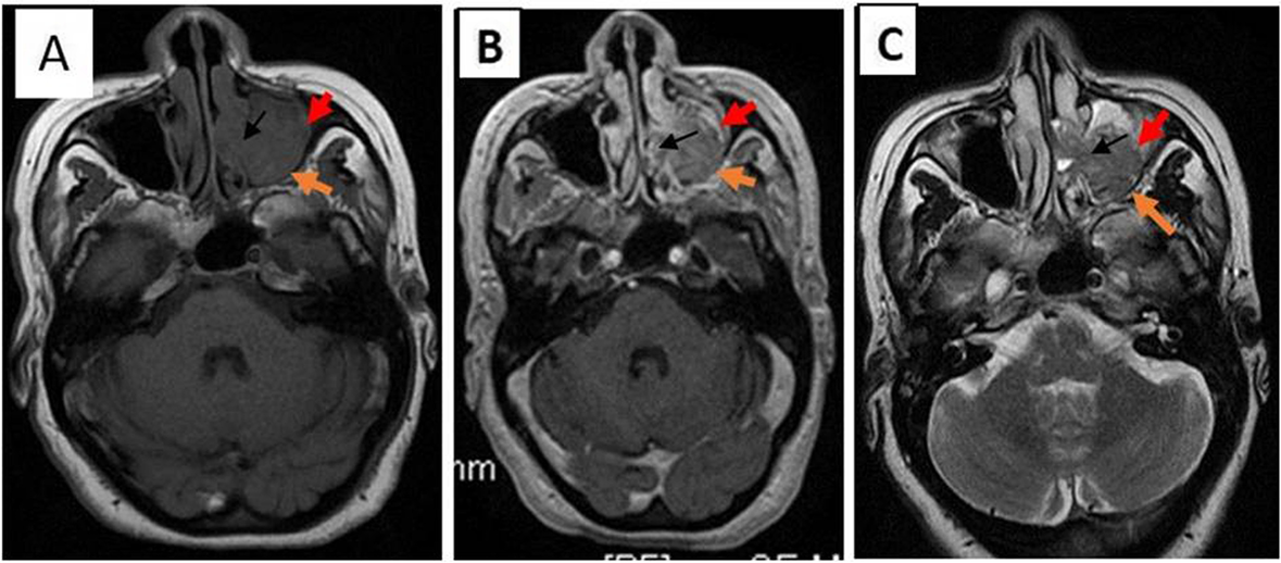 Fig. 5