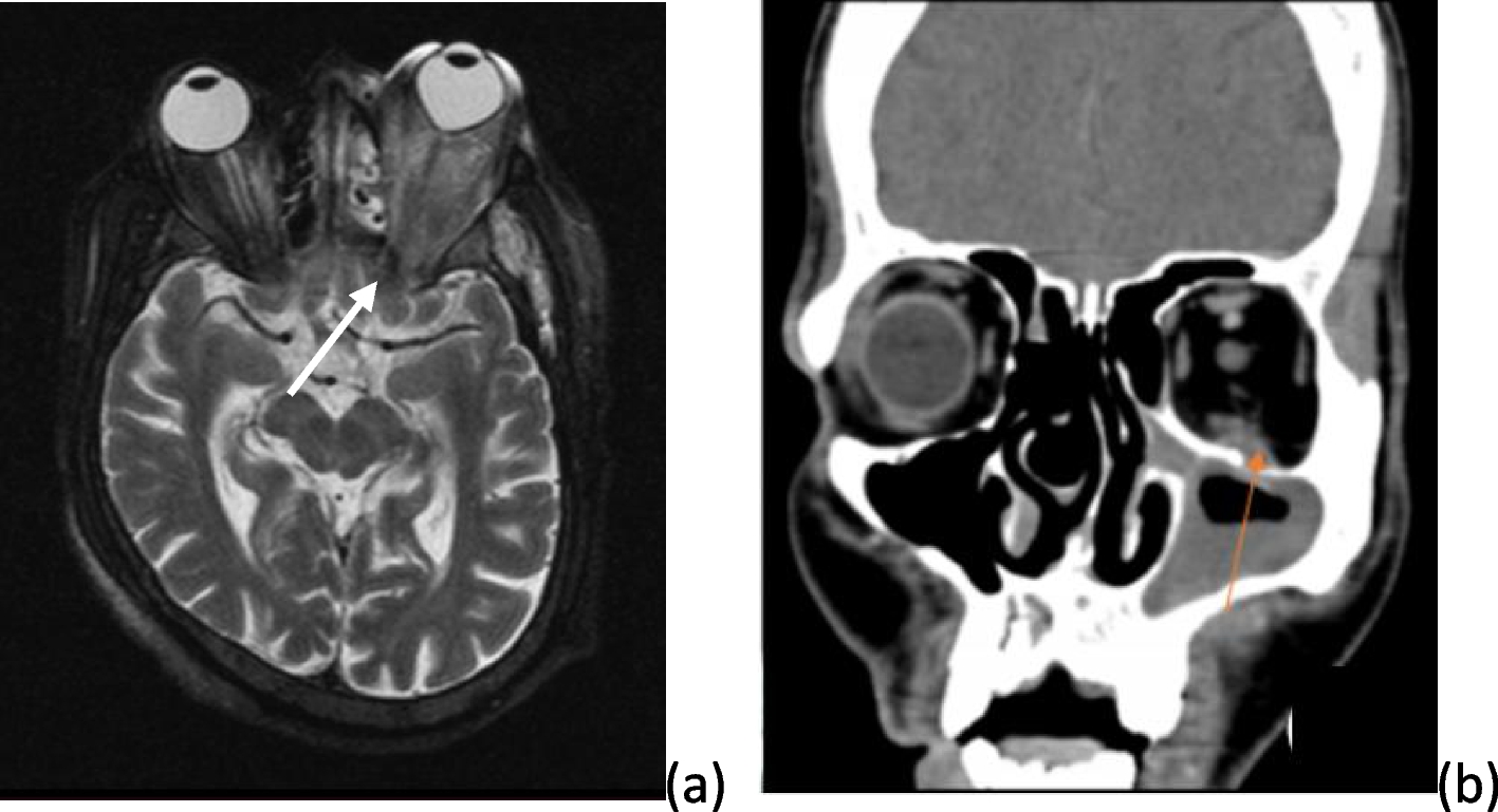 Fig. 5