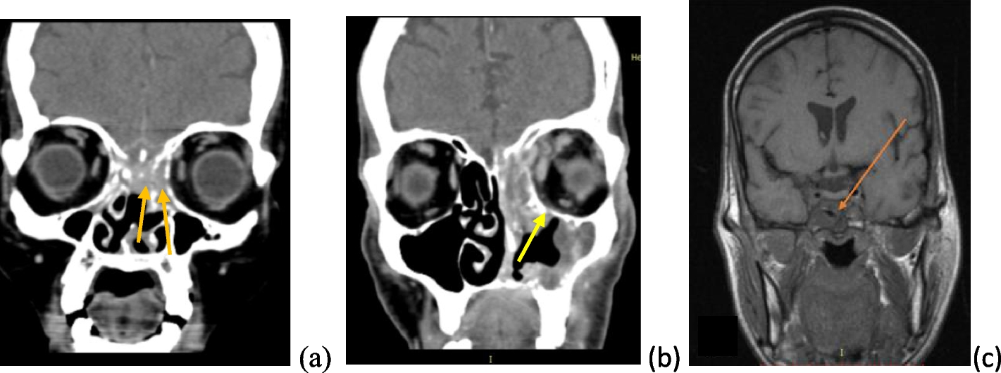 Fig. 7