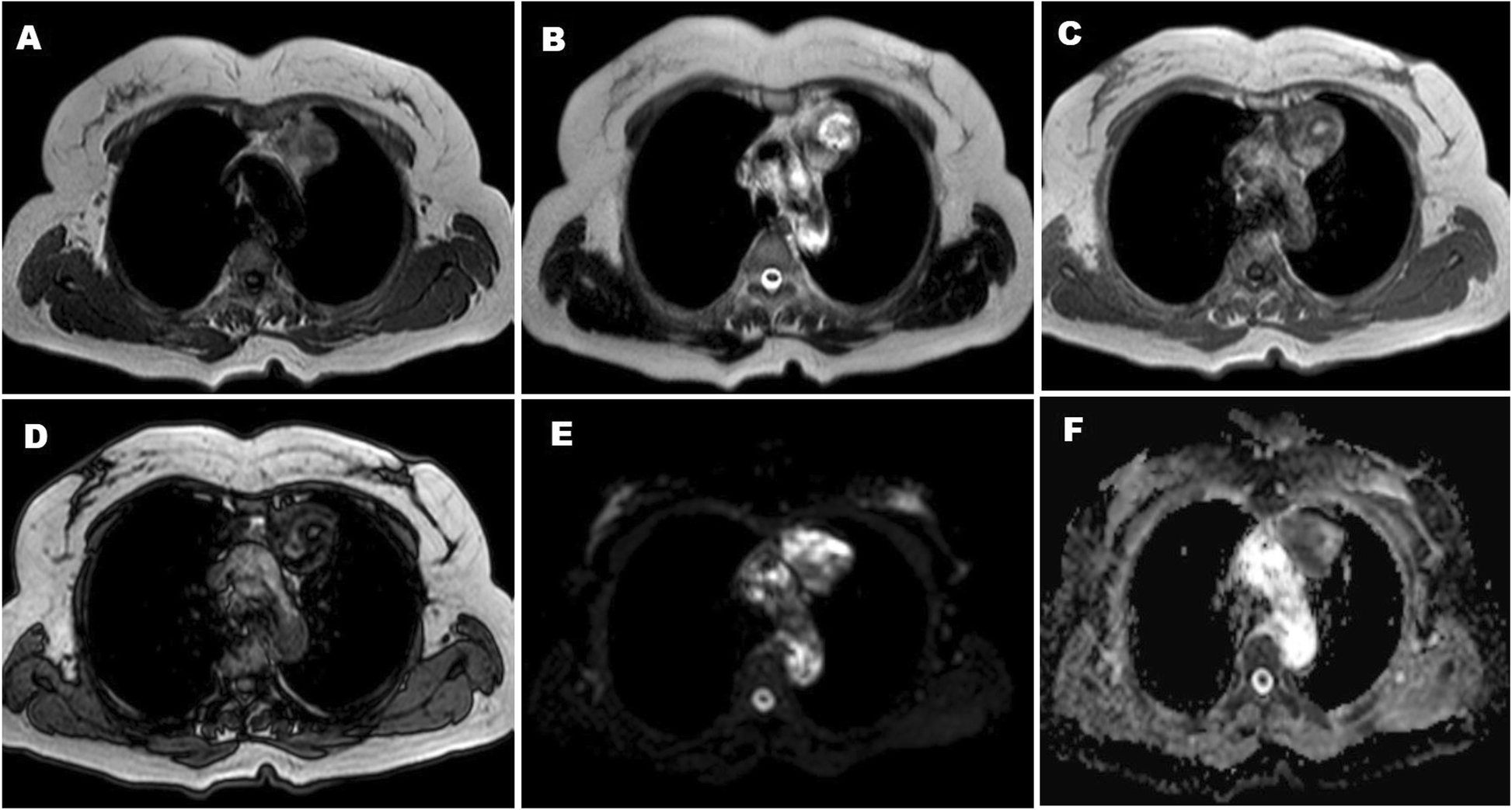 Fig. 5