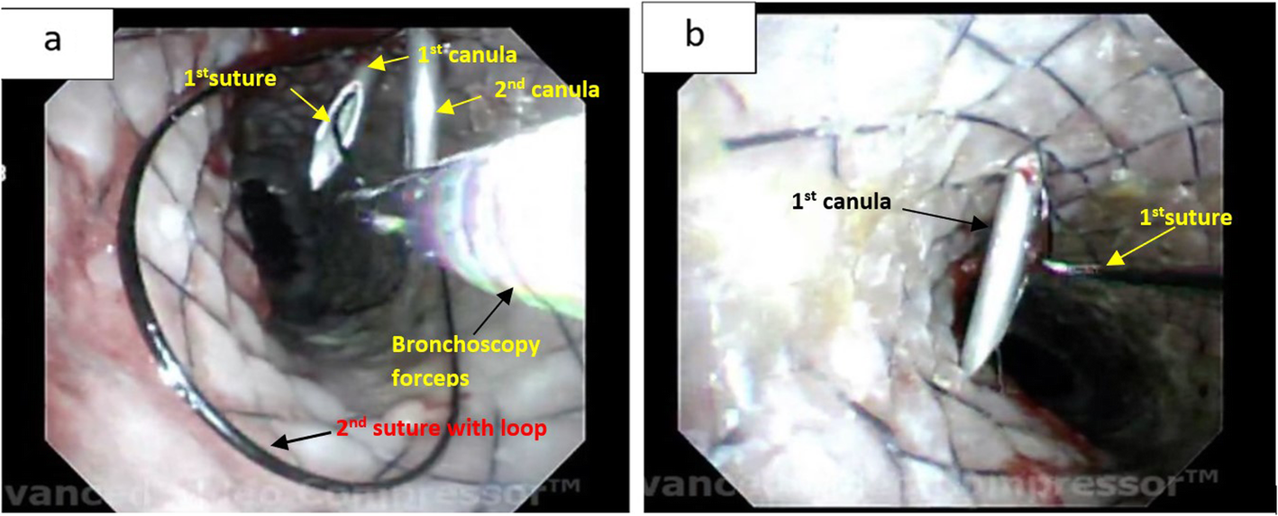 Fig. 4