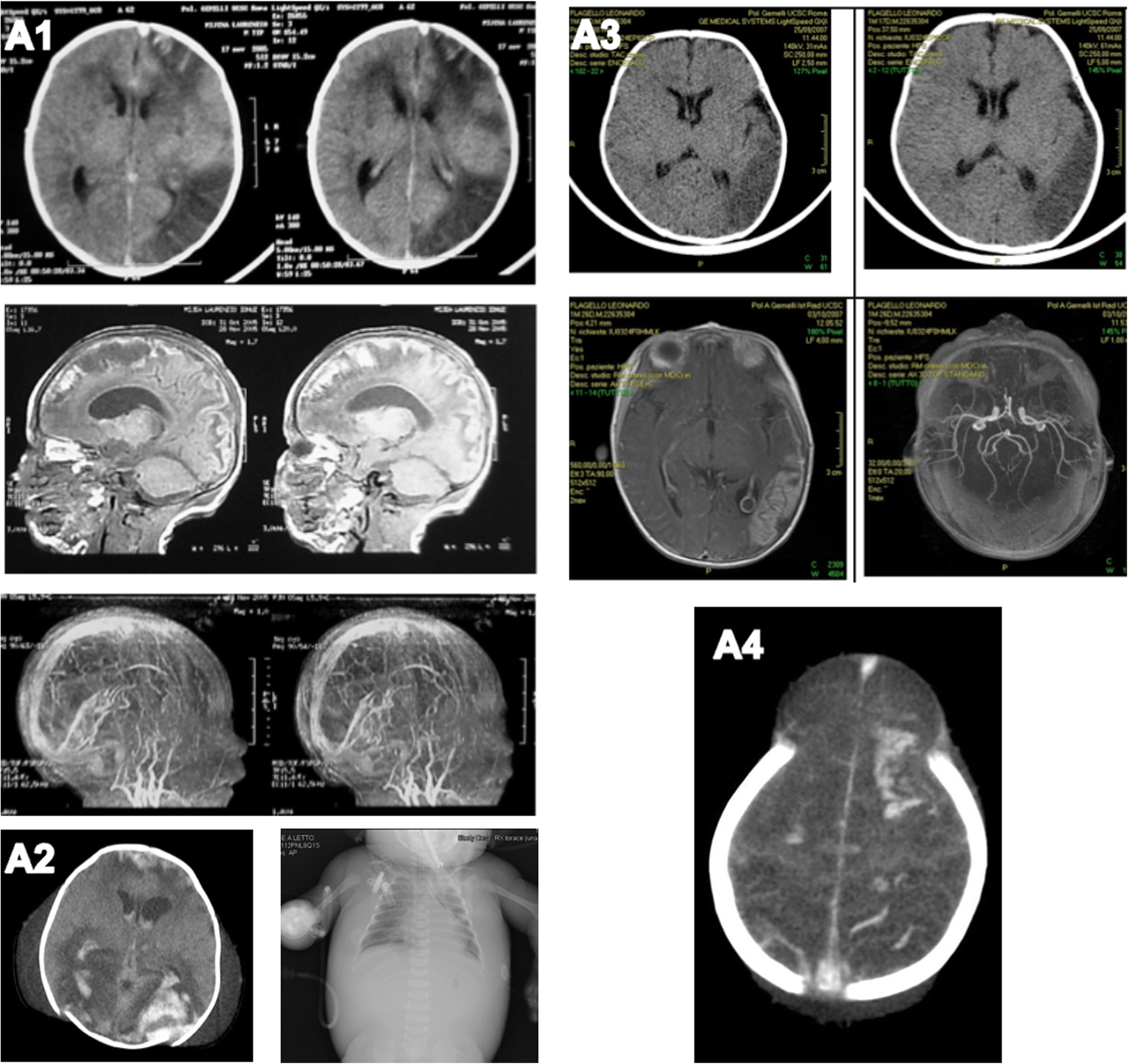 Fig. 1