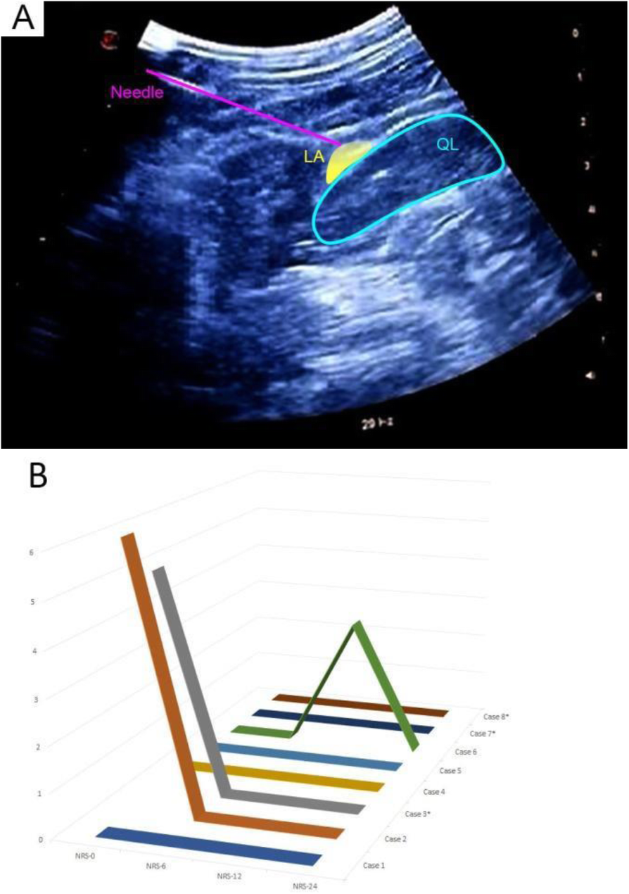 Fig. 1 (abstract A41).