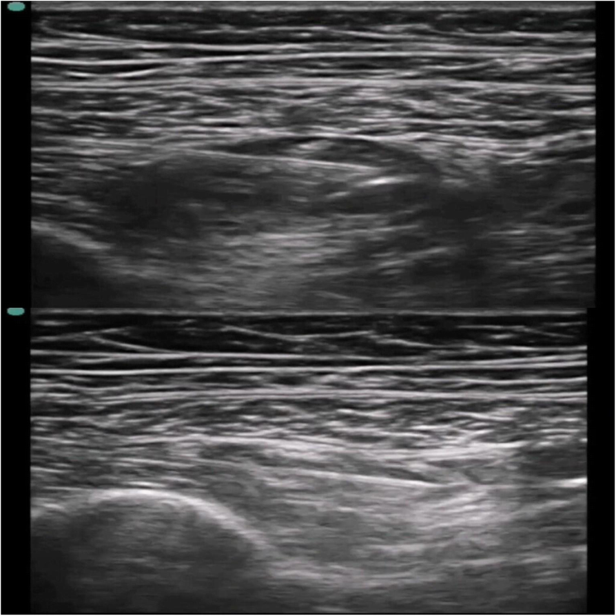 Fig. 1 (abstract A44).