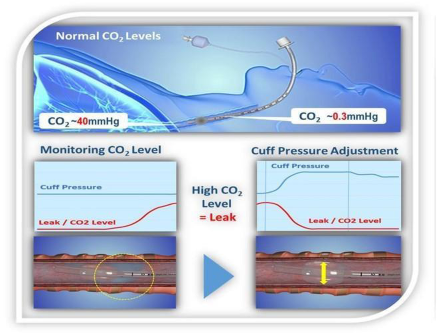 Fig. 1 (abstract A105).