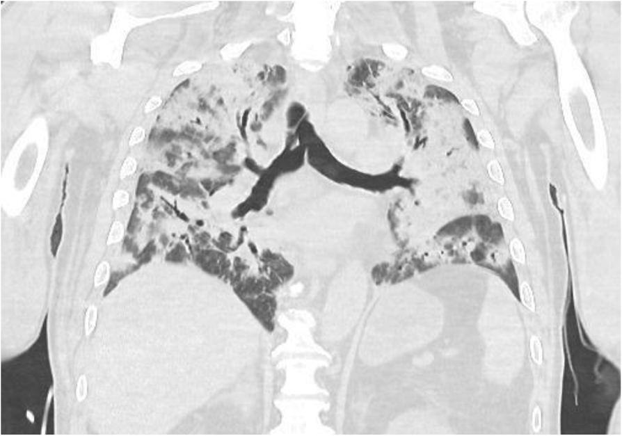 Fig. 1 (abstract A114).