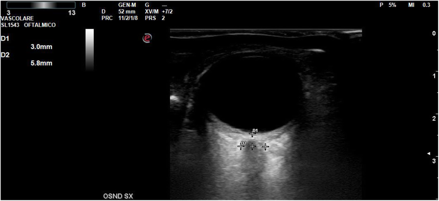 Fig. 2 (abstract A143).