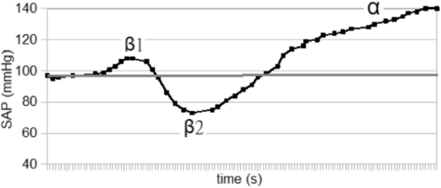 Fig. 4 (abstract A16).