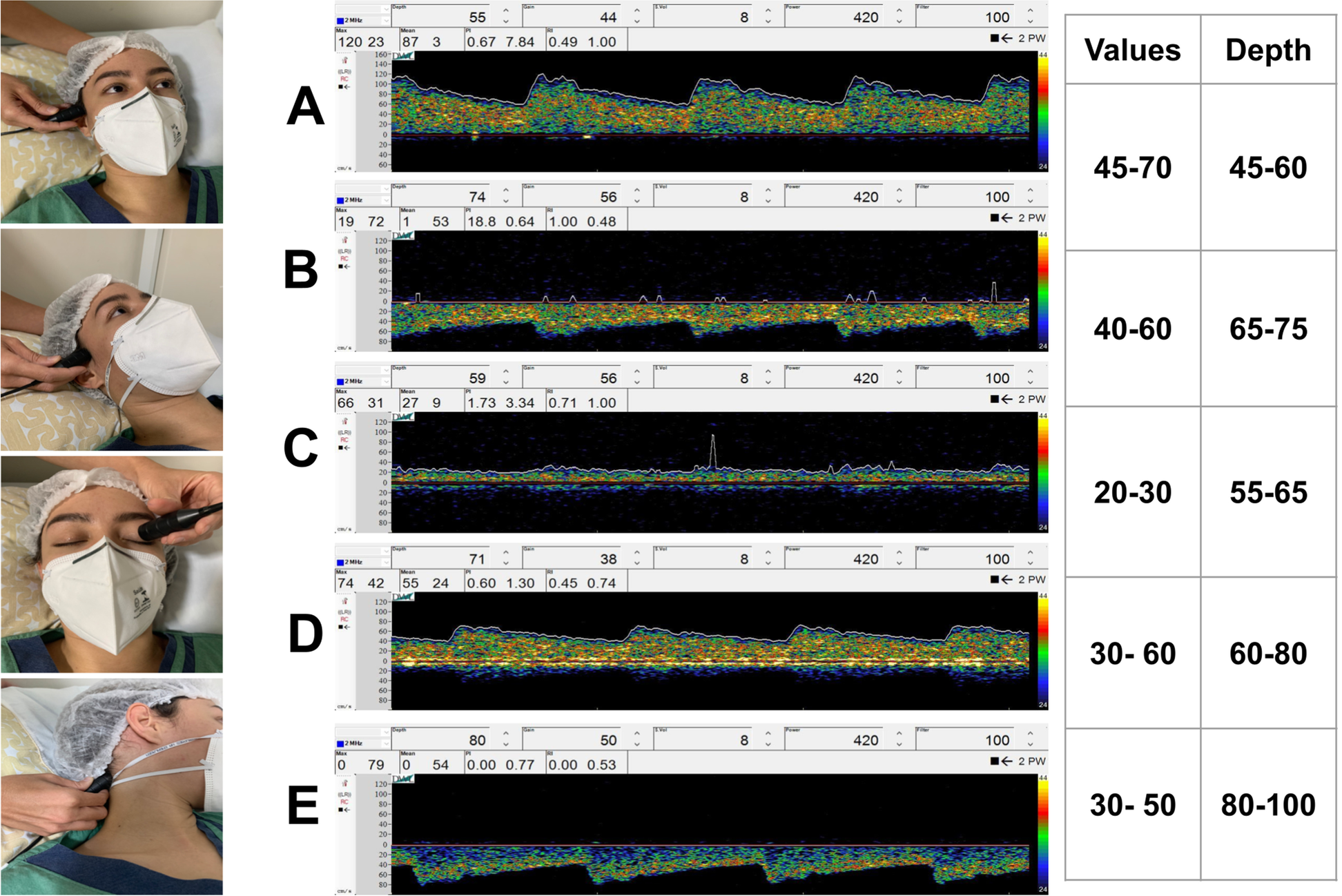 Fig. 2