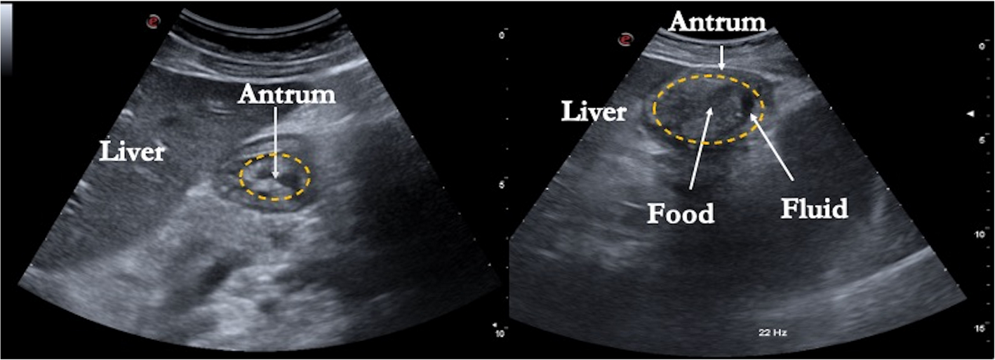 Fig. 1
