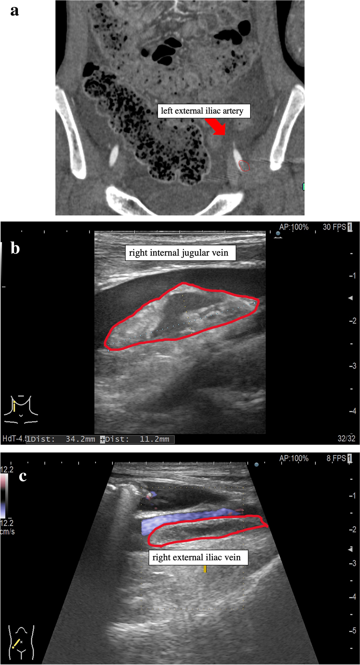 Fig. 3