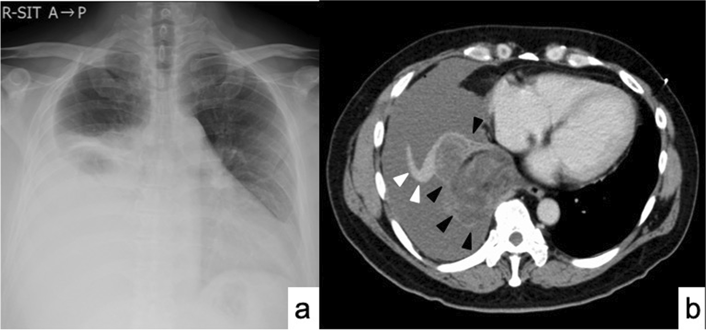 Fig. 1 a