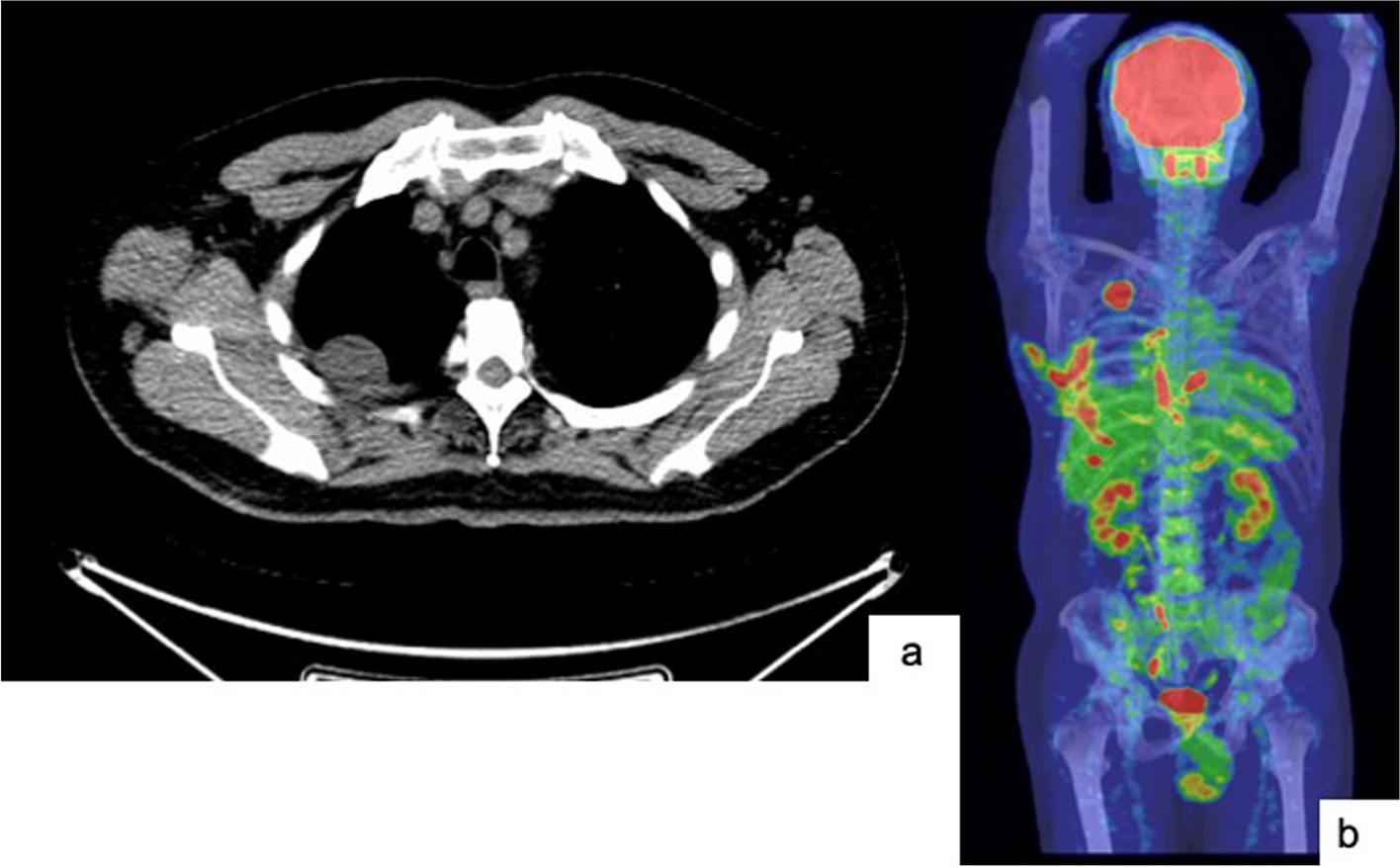 Fig. 3 a-b