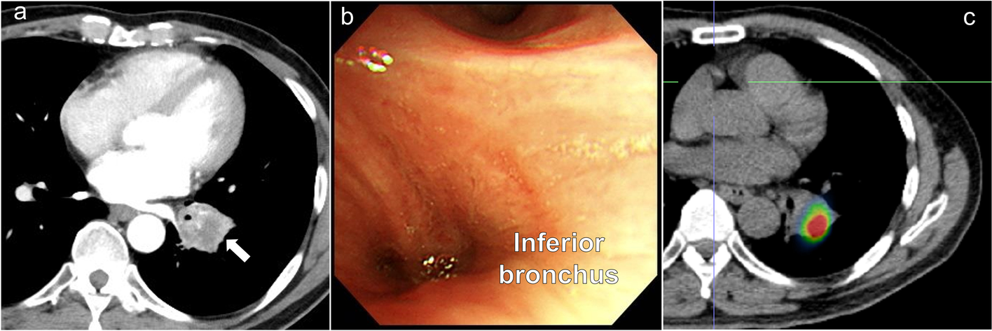 Fig. 1