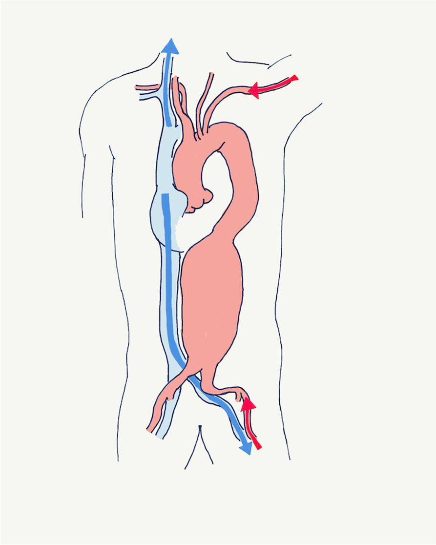 Fig. 2