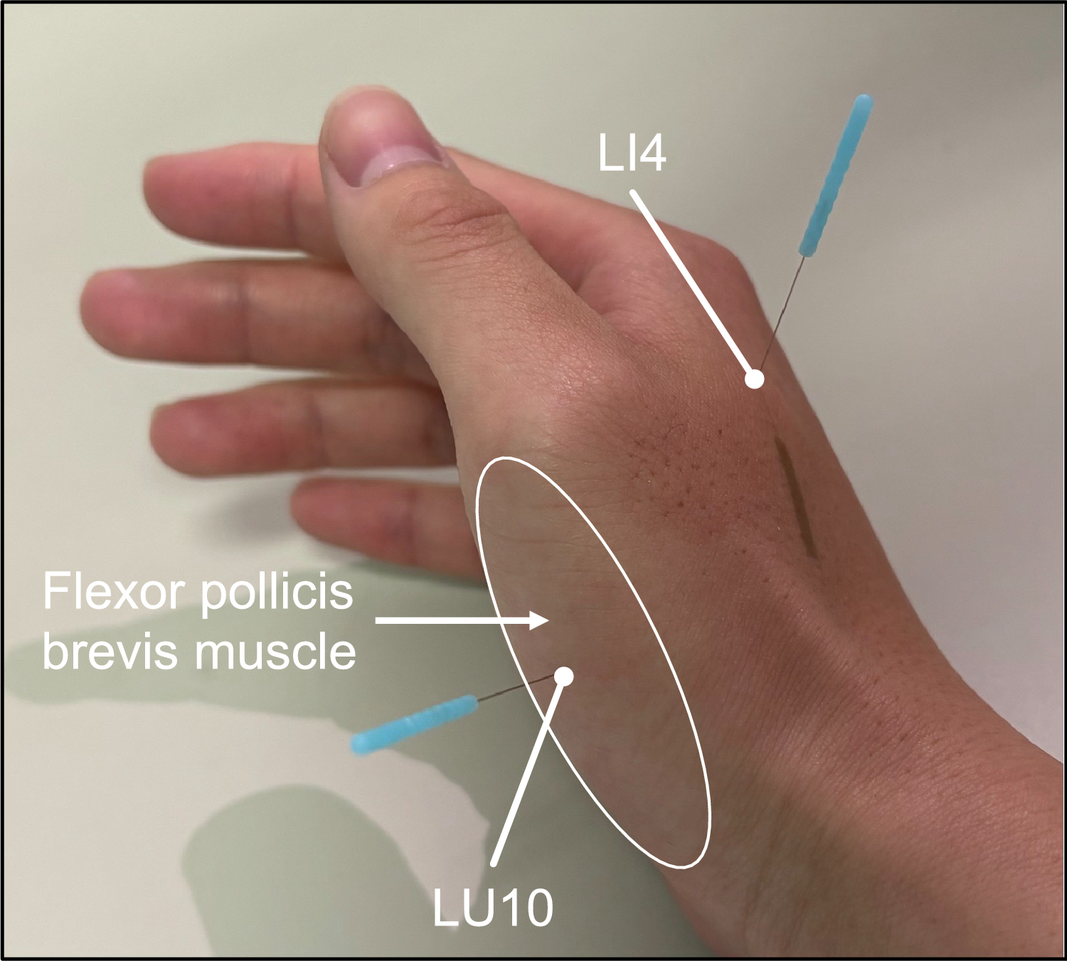 Fig. 2