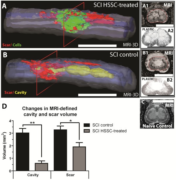 Amelioration of motor/sensory dysfunction and spasticity in a rat model of  acute lumbar spinal cord injury by human neural stem cell transplantation |  Stem Cell Research & Therapy | Full Text